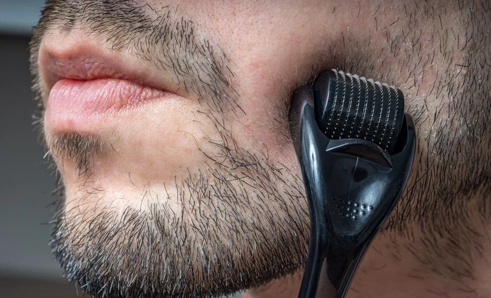 Derma Rolling for Beard Growth: What the Science Says
